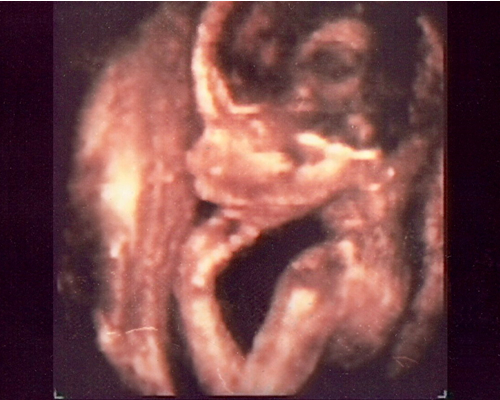 Fotografía de un feto